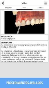 aplicaciones-para-clinicas-dentales-periopixel-pro