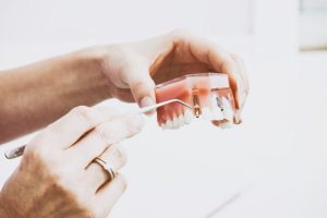 biomateriales-dentales-implante-dental-768x512