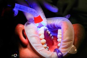 biomateriales-dentales-paciente-hombre-clinica-dental-768x512