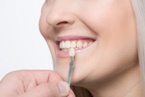 Using shade guide at woman's mouth to check veneer of tooth crown