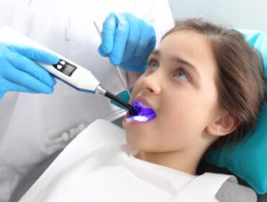 Seal Light-cure, the child in the dental office