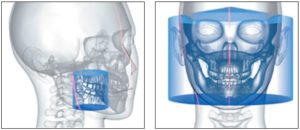 radiologia-dental-3d-campo-de-vision-768x333