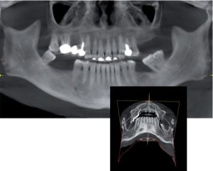radiologia-dental-3d-ejemplo-comparativo-habitual-768x617