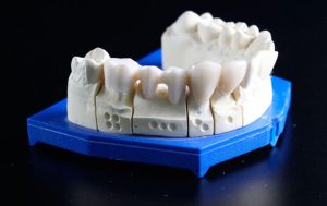 tipos-de-oclusion-dental-mandibula-caninos-premolares-768x485