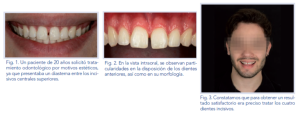 tratamiento-odontologico-estetico-vista-intraoral-morfologia.alt_-768x293