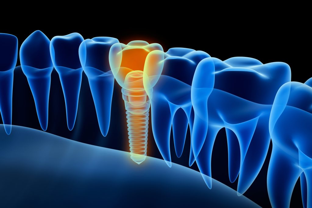El futuro de la IA en Odontología