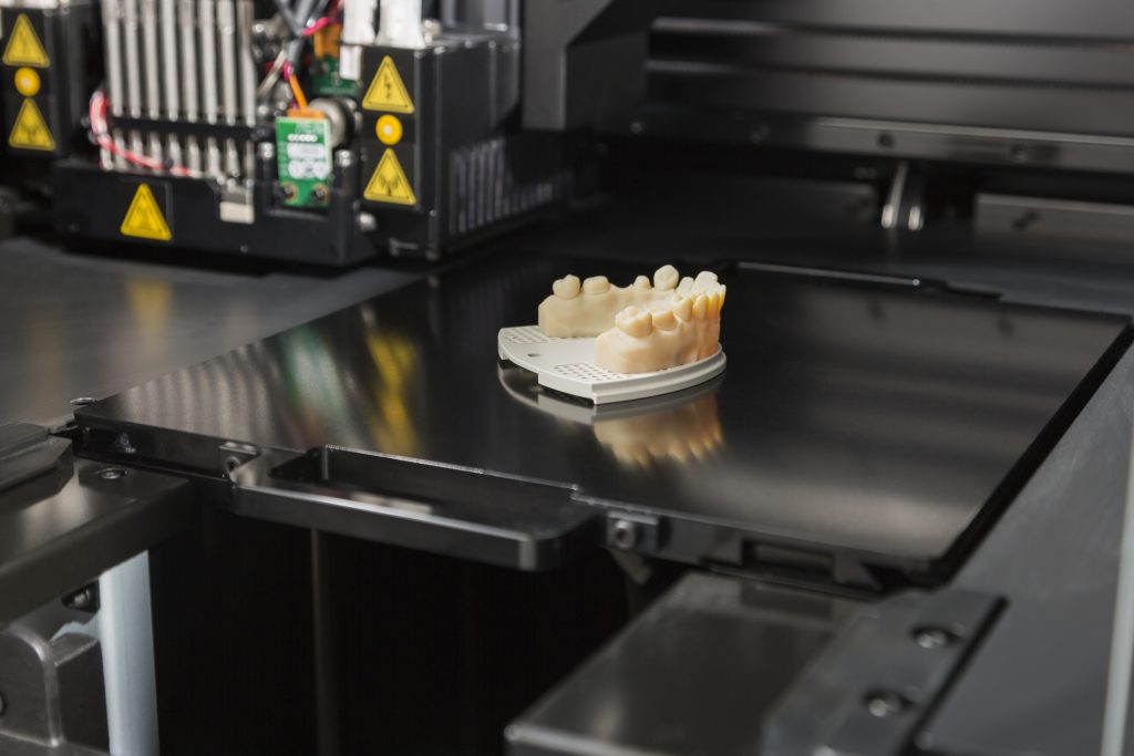 Ventajas de las impresoras 3D en Odontología